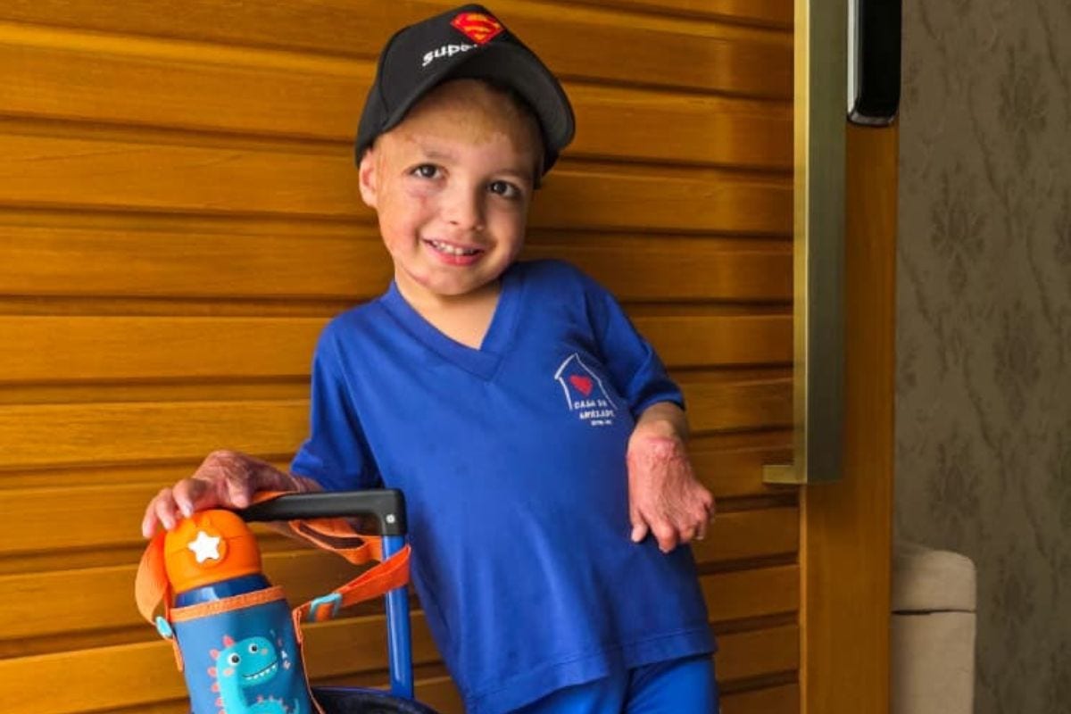 Luquinhas entrou no pré-escolar este ano e segue em fisioterapia para recuperar totalmente os movimentos das mãos