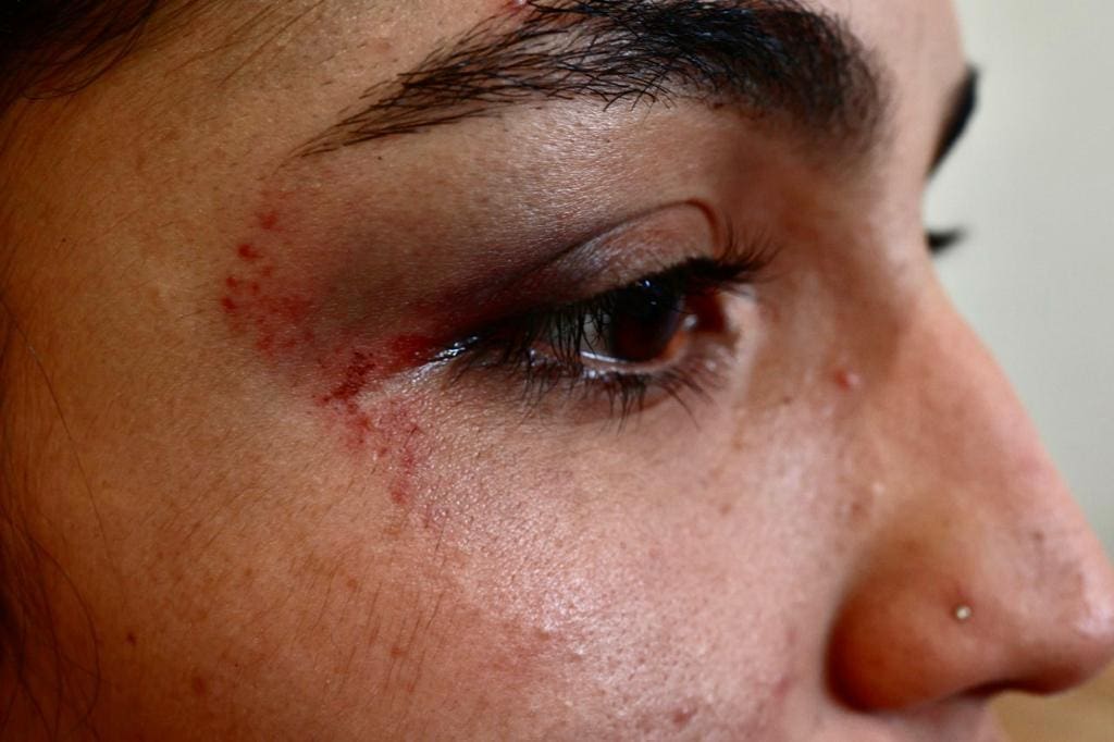 Vítima está com diversos hematomas no rosto.
