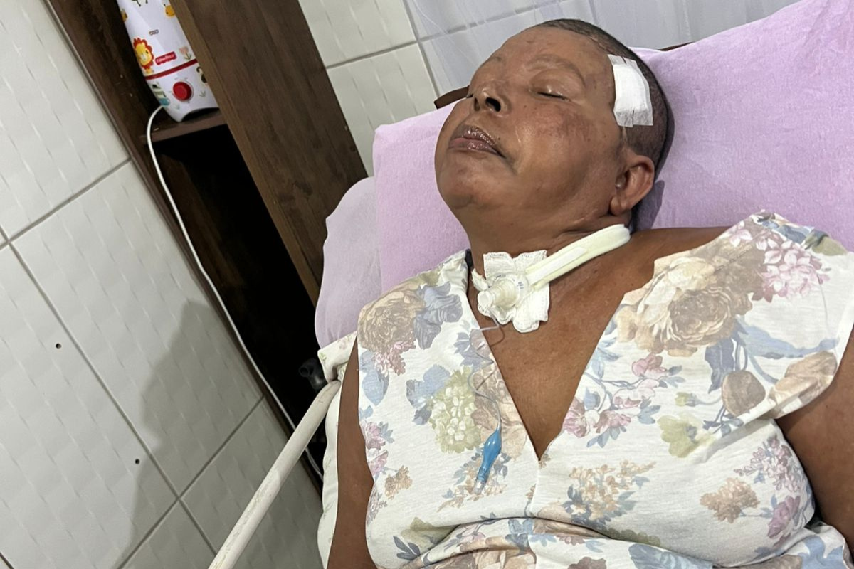 Ex-cantineira vive em estado vegetativo, sob cuidados paliativos em casa